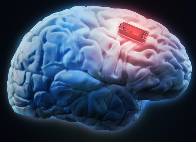 کاشت ایمپلنت مغزی می تواند باعث تغییر در شخصیت افراد شود| تکلی کاشت ایمپلنت مغزی می تواند باعث تغییر در شخصیت افراد شود| تکلی