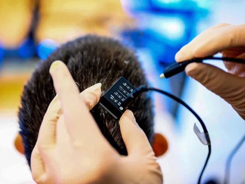 اضافه شدن هوش مصنوعی به ایمپلنت مغزی سرعت تکلم در بیماران فلج را افزایش میدهد|تکلی اضافه شدن هوش مصنوعی به ایمپلنت مغزی سرعت تکلم در بیماران فلج را افزایش میدهد|تکلی