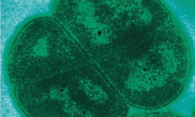 احتمالا حیات میکروبی در مریخ ۲۸۰ میلیون سال قدمت دارد| تاج من احتمالا حیات میکروبی در مریخ ۲۸۰ میلیون سال قدمت دارد| تاج من