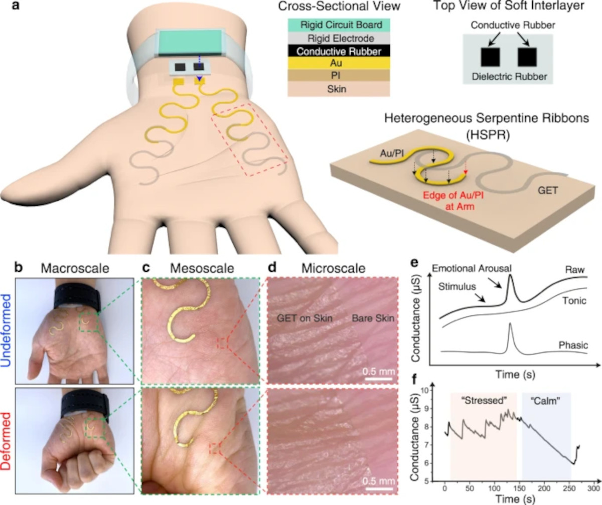 تتوی الکترونیکی می تواند میزان استرس را از طریق کف دست اندازه گیری کند| تکلی تتوی الکترونیکی می تواند میزان استرس را از طریق کف دست اندازه گیری کند| تکلی
